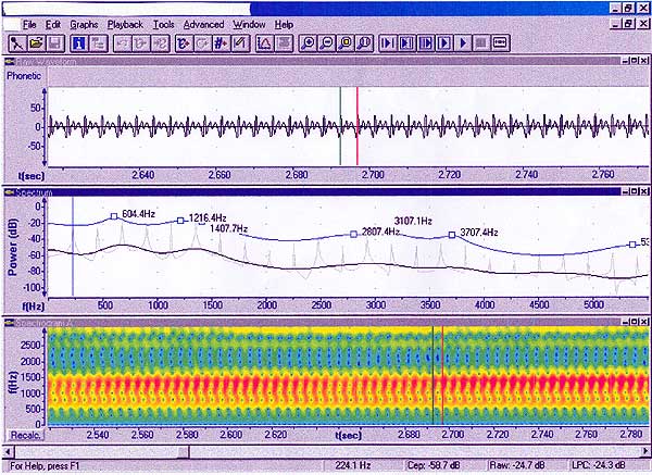 analisis informatizado de la voz